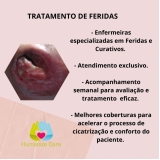 enfermagem domiciliar para tratamento de feridas preço Serra Gaúcha